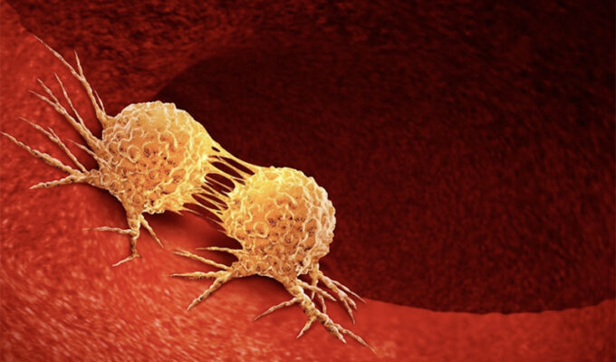 el-lago-de-los-cisnes-homero-y-la-metastasis