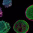 organoides-la-ciencia-sin-ficcion-micro-organos-que-revolucionan-la-medicina